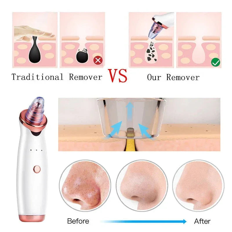 Facial Blackhead Remover Electric Vacuum Machine Default Title