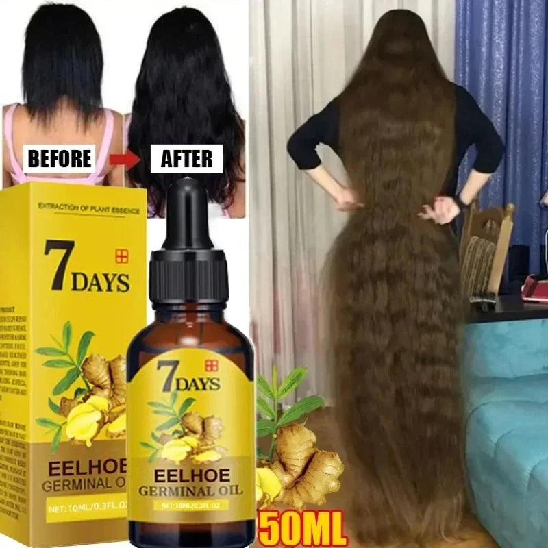 Hair Growth Oil Ginger Growth Hair Treatment Anti Hair Loss Men Women Scalp Treatment Serum