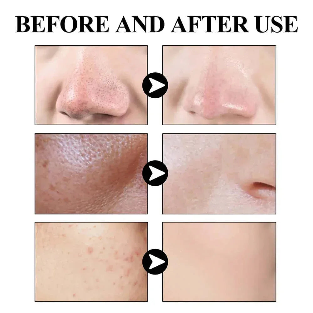 West & Month Blackhead Remove Solid Mud Film Refreshing Skin Cleaning Face Mask Default Title