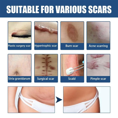 Scar Balm, Surgery Scar Repair Cold Compress Scar Skin Scar Gel Balm default title