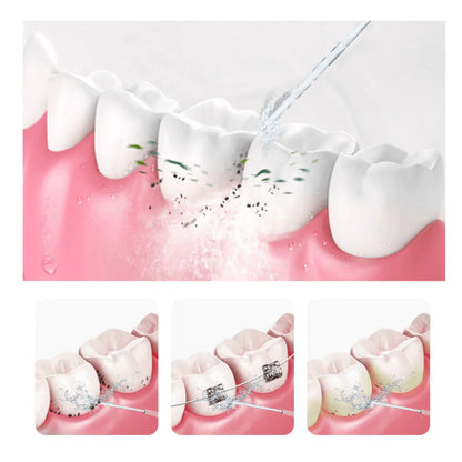 Portable Water Flosser And Pik For Dental Hygiene Default Title