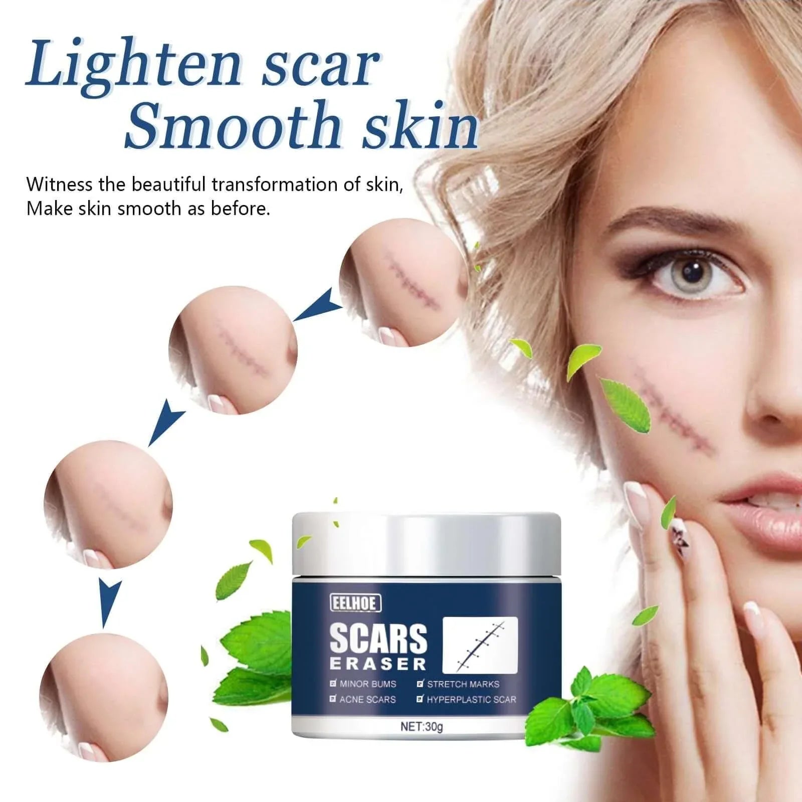 Scar Balm, Surgery Scar Repair Cold Compress Scar Skin Scar Gel Balm default title