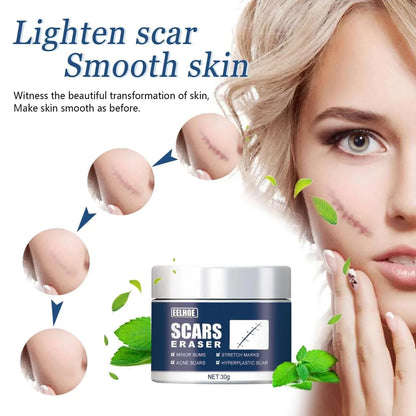 Scar Balm, Surgery Scar Repair Cold Compress Scar Skin Scar Gel Balm default title