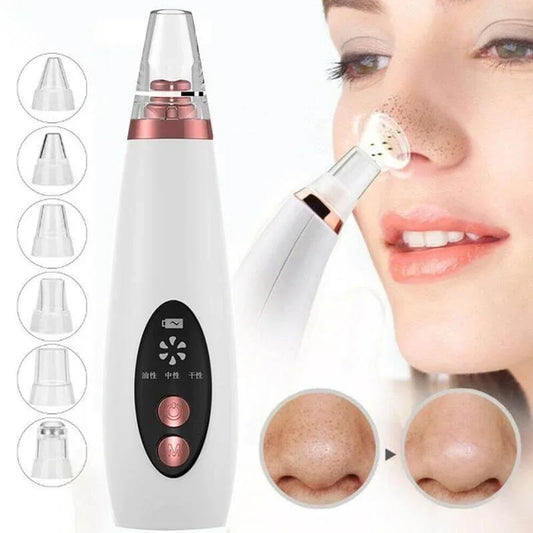 Pore Vacuum & Blackhead Remover White
