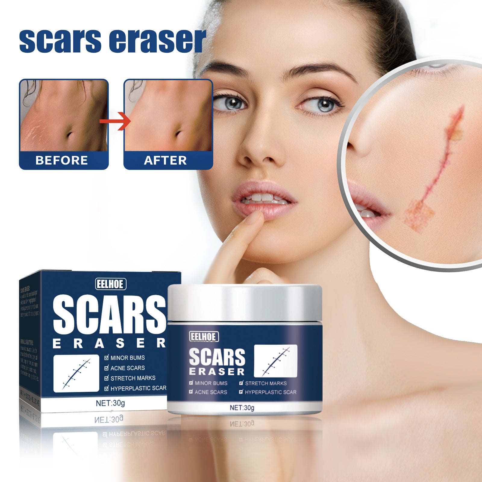 Scar Balm, Surgery Scar Repair Cold Compress Scar Skin Scar Gel Balm