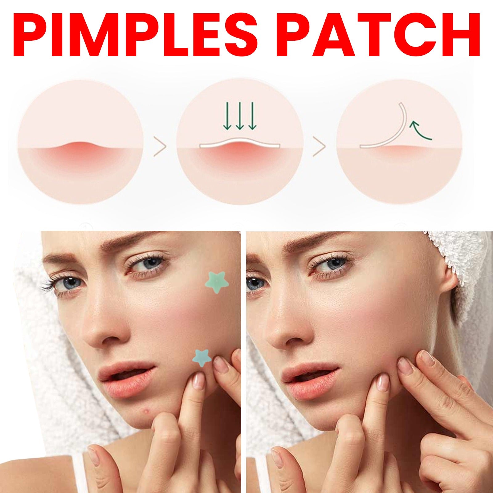 Acne Patch Facial Skin Care Fade Blemishes Pimple Marks Closed Acne Blemishes Cover Acne Pimple Repair Patch