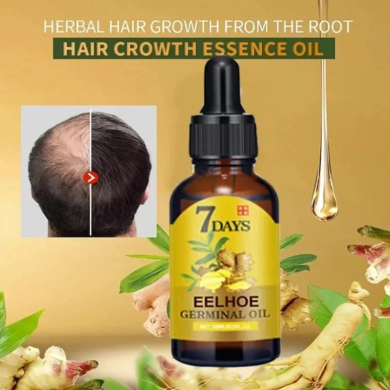 Hair Growth Oil Ginger Growth Hair Treatment Anti Hair Loss Men Women Scalp Treatment Serum