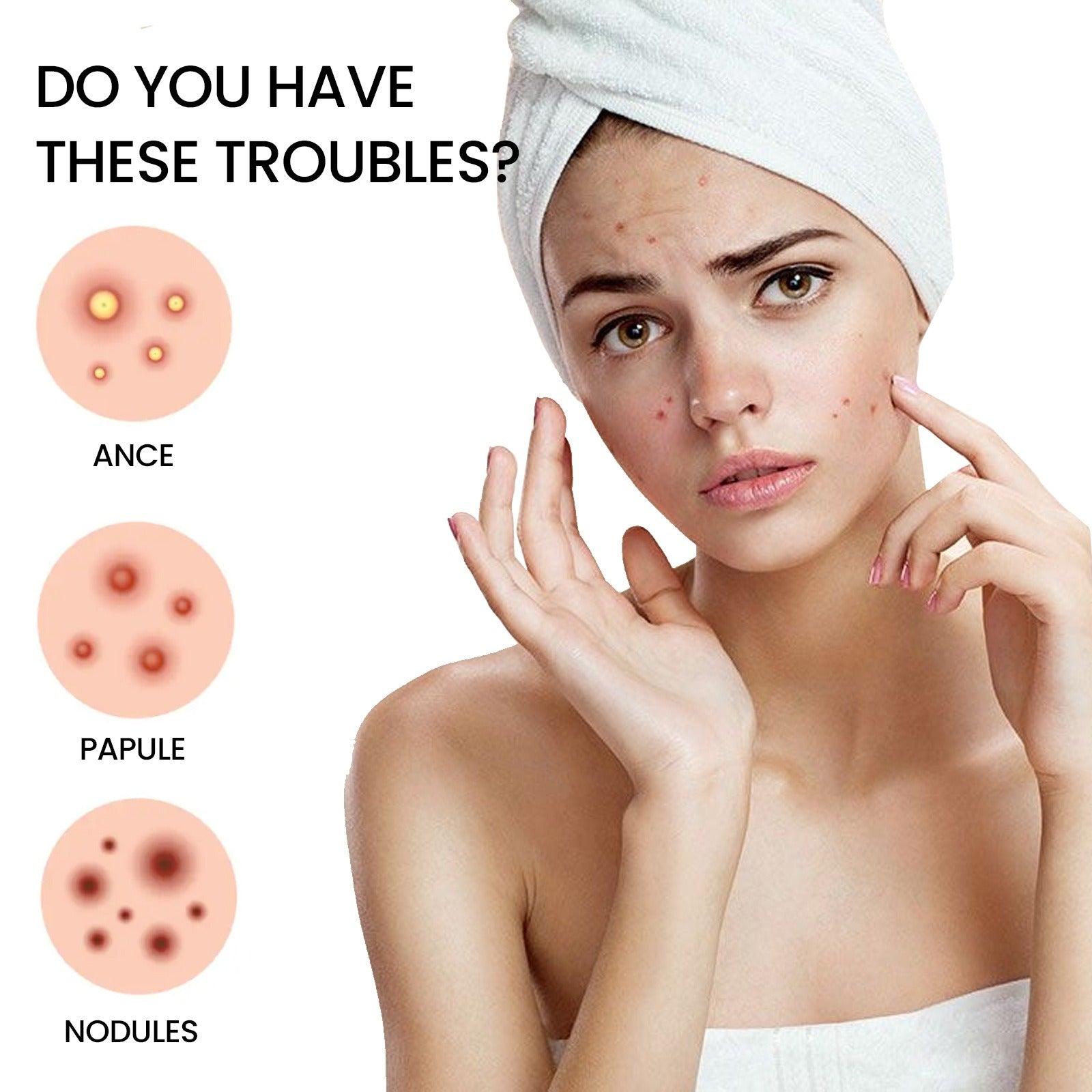 Acne Patch Facial Skin Care Fade Blemishes Pimple Marks Closed Acne Blemishes Cover Acne Pimple Repair Patch