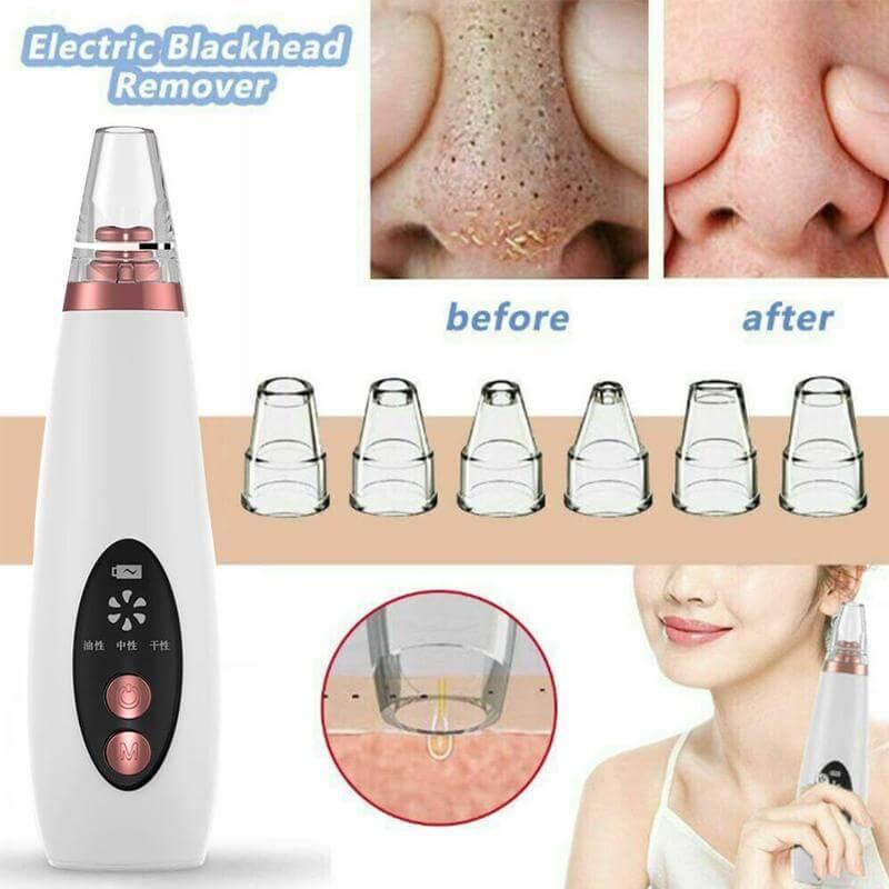 Pore Vacuum & Blackhead Remover White
