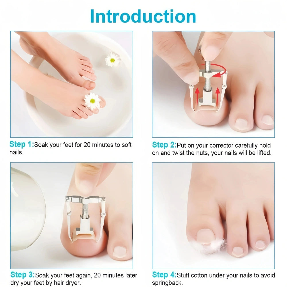 Ingrown Toenail Corrector – Stainless Steel Toenail Correction Tool, Gold/Silver