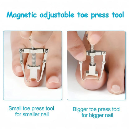 Ingrown Toenail Corrector – Stainless Steel Toenail Correction Tool, Gold/Silver