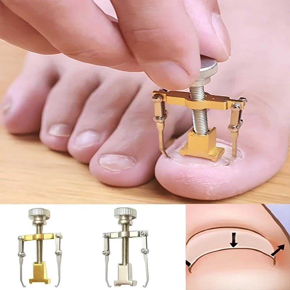 Ingrown Toenail Corrector – Stainless Steel Toenail Correction Tool, Gold/Silver