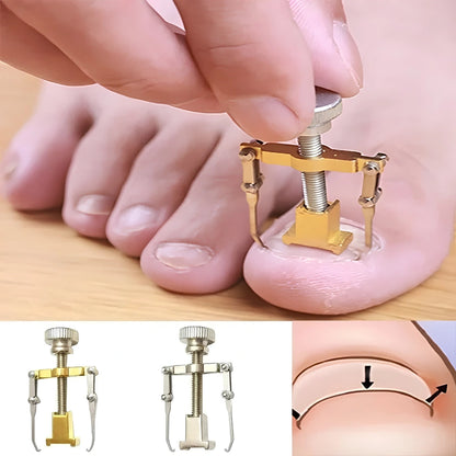 Ingrown Toenail Corrector – Stainless Steel Toenail Correction Tool, Gold/Silver