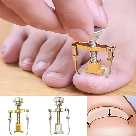 Ingrown Toenail Corrector – Stainless Steel Toenail Correction Tool, Gold/Silver