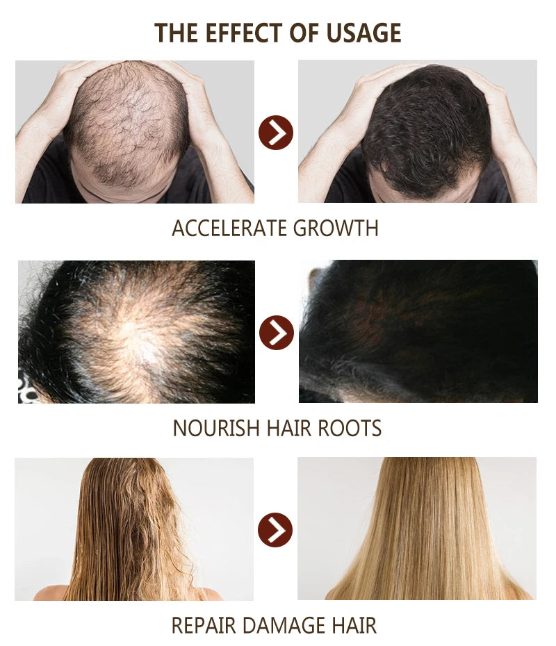 Hair Growth Oil Fast Hair Growth Effective Baldness Repair