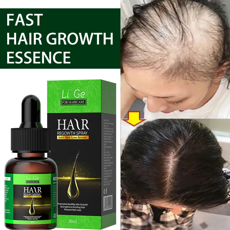 Hair Growth Oil Fast Hair Growth Effective Baldness Repair