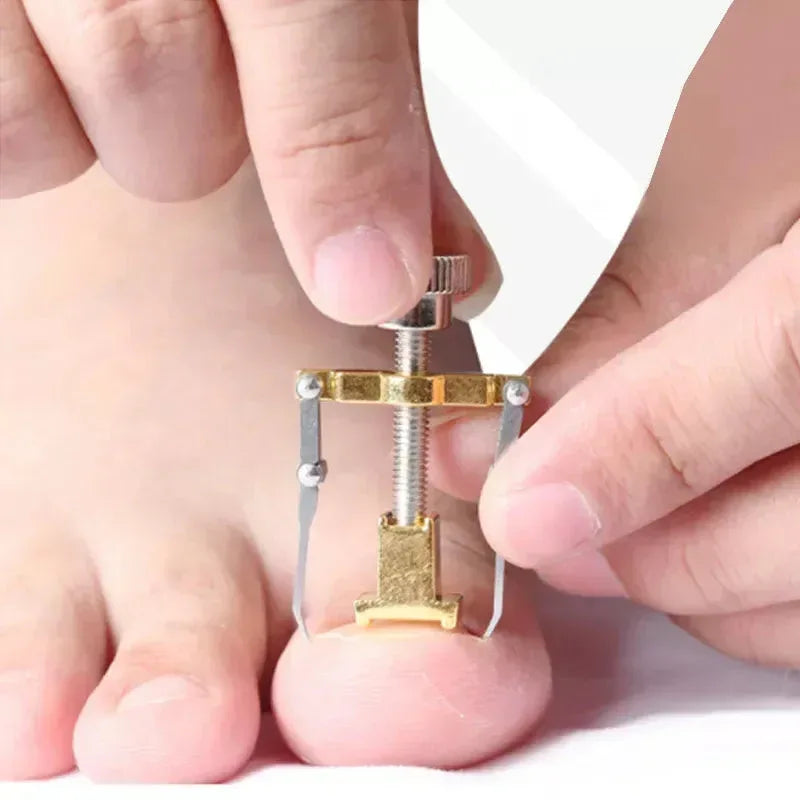 Stainless Steel Nail Ingrown Toenails Corrector Gold