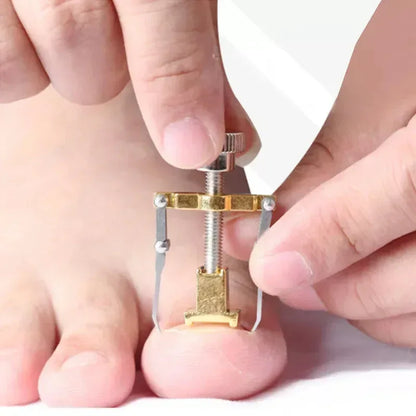 Stainless Steel Nail Ingrown Toenails Corrector Gold