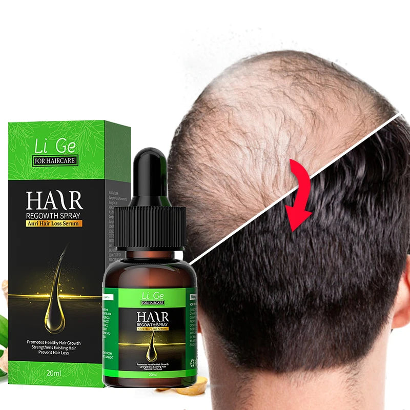 Hair Growth Oil Fast Hair Growth Effective Baldness Repair