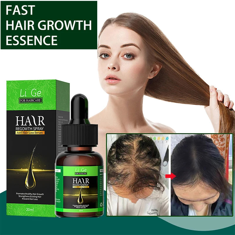 Hair Growth Oil Fast Hair Growth Effective Baldness Repair