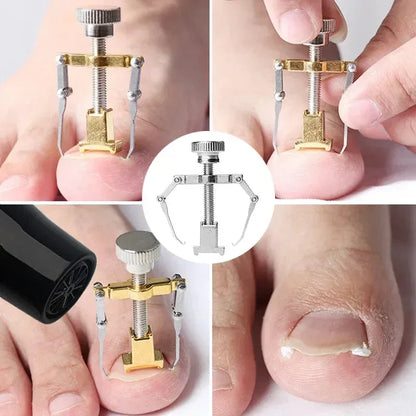 Stainless Steel Nail Ingrown Toenails Corrector Gold