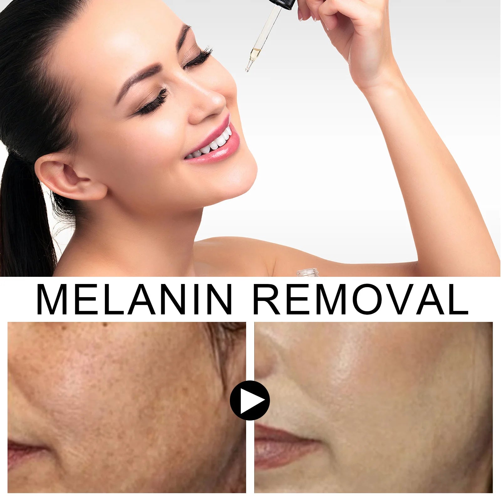 Pigment Removal Serum