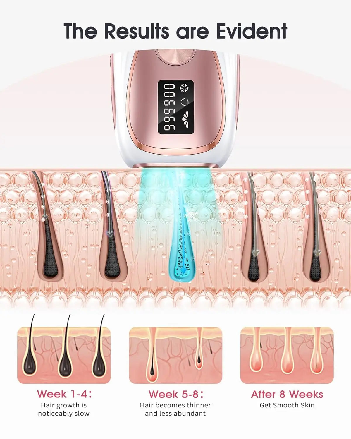 Hair Removal Laser