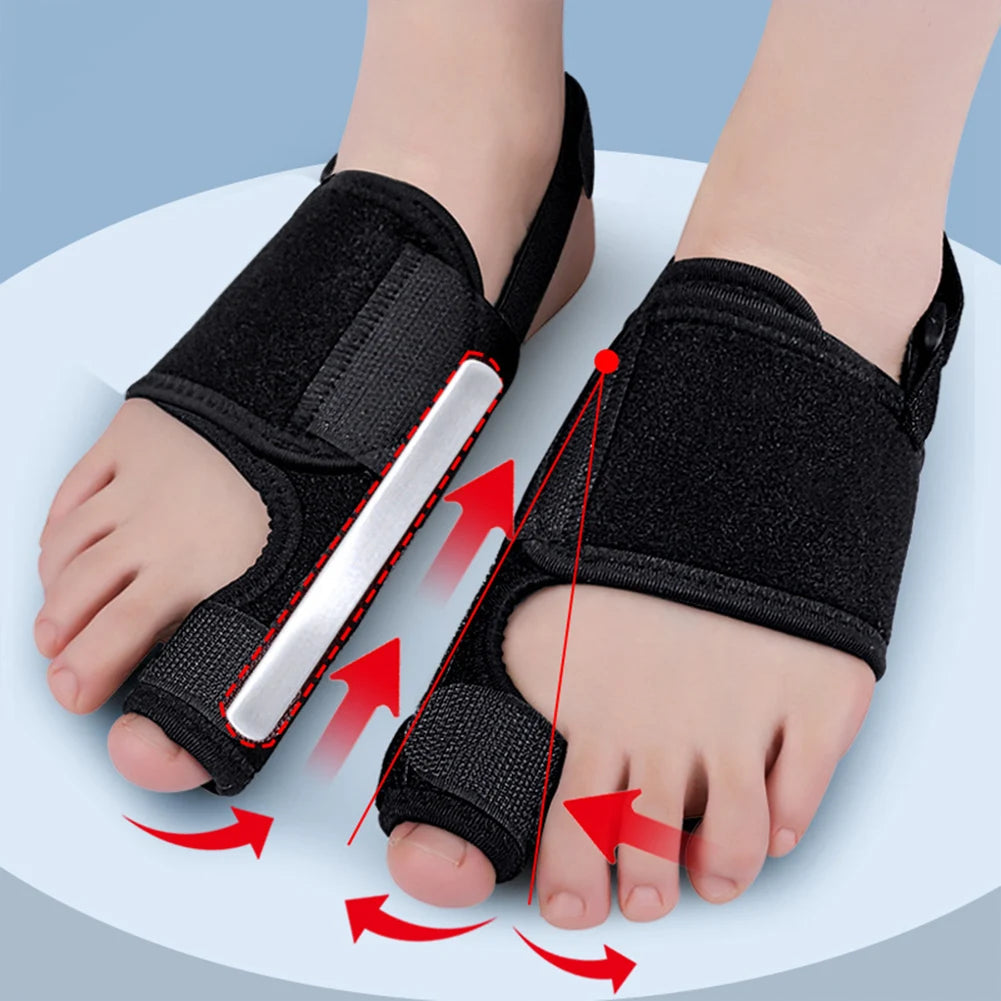 Toe Corrector Orthopedic Tool for Bunion and Hallux Valgus Relief Minx