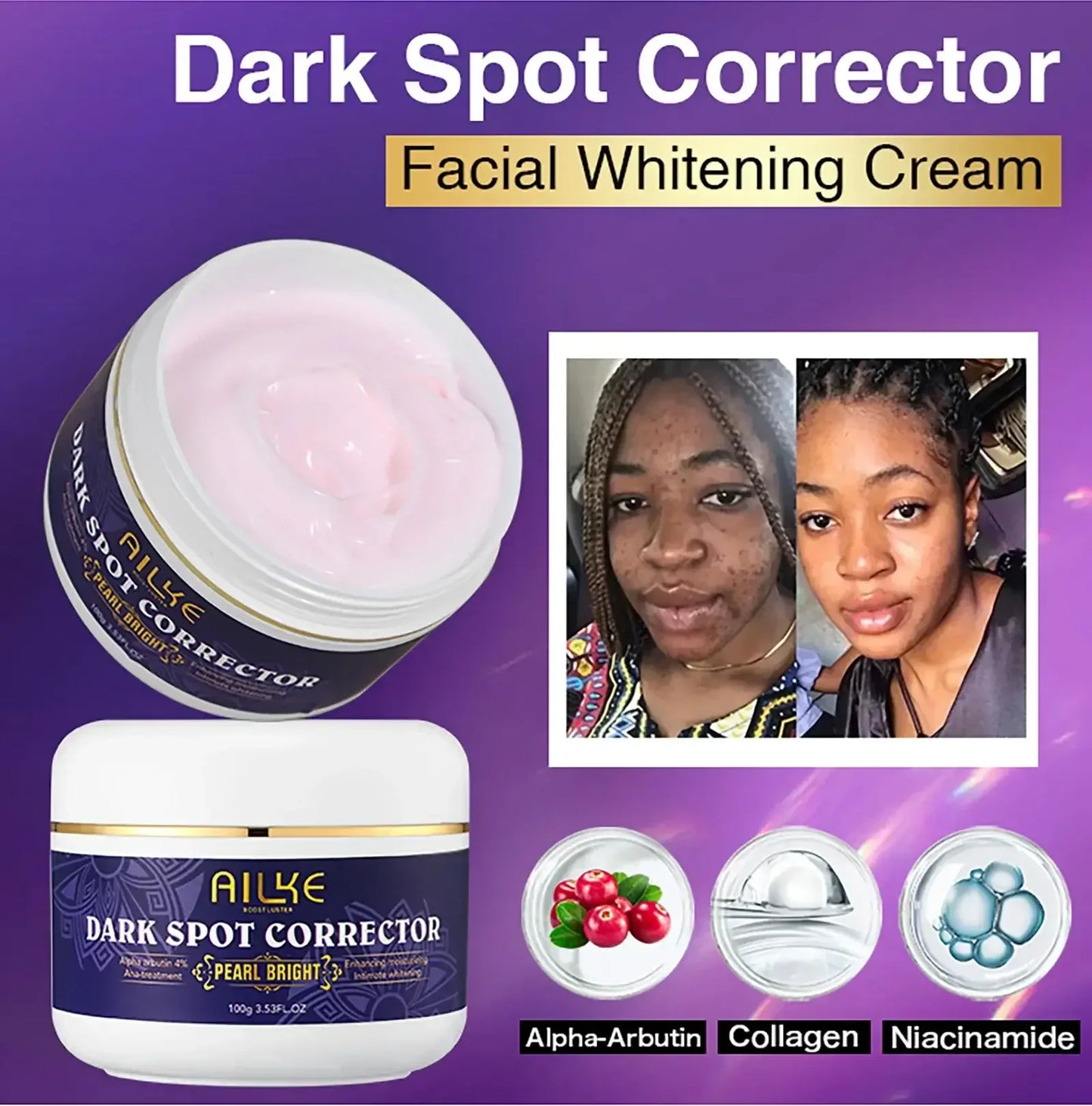Dark Spot Remover Cream 2 Bottle