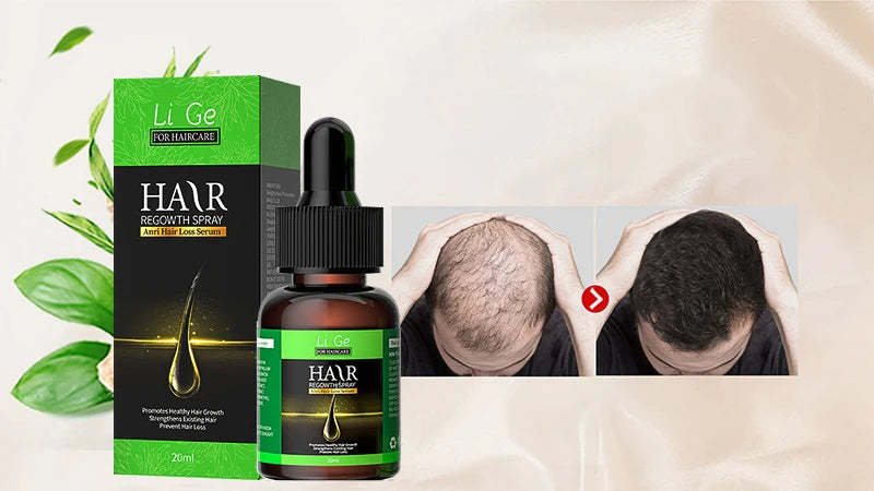 Hair Growth Oil Fast Hair Growth Effective Baldness Repair