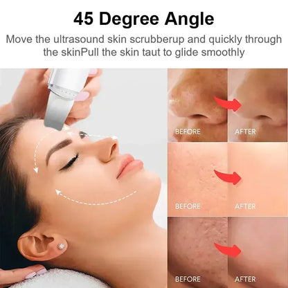 Ultrasonic Skin Scrubber and Facial Lifting skin care Green with box