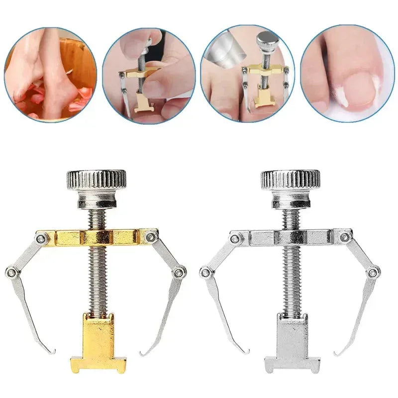 Stainless Steel Nail Ingrown Toenails Corrector Gold