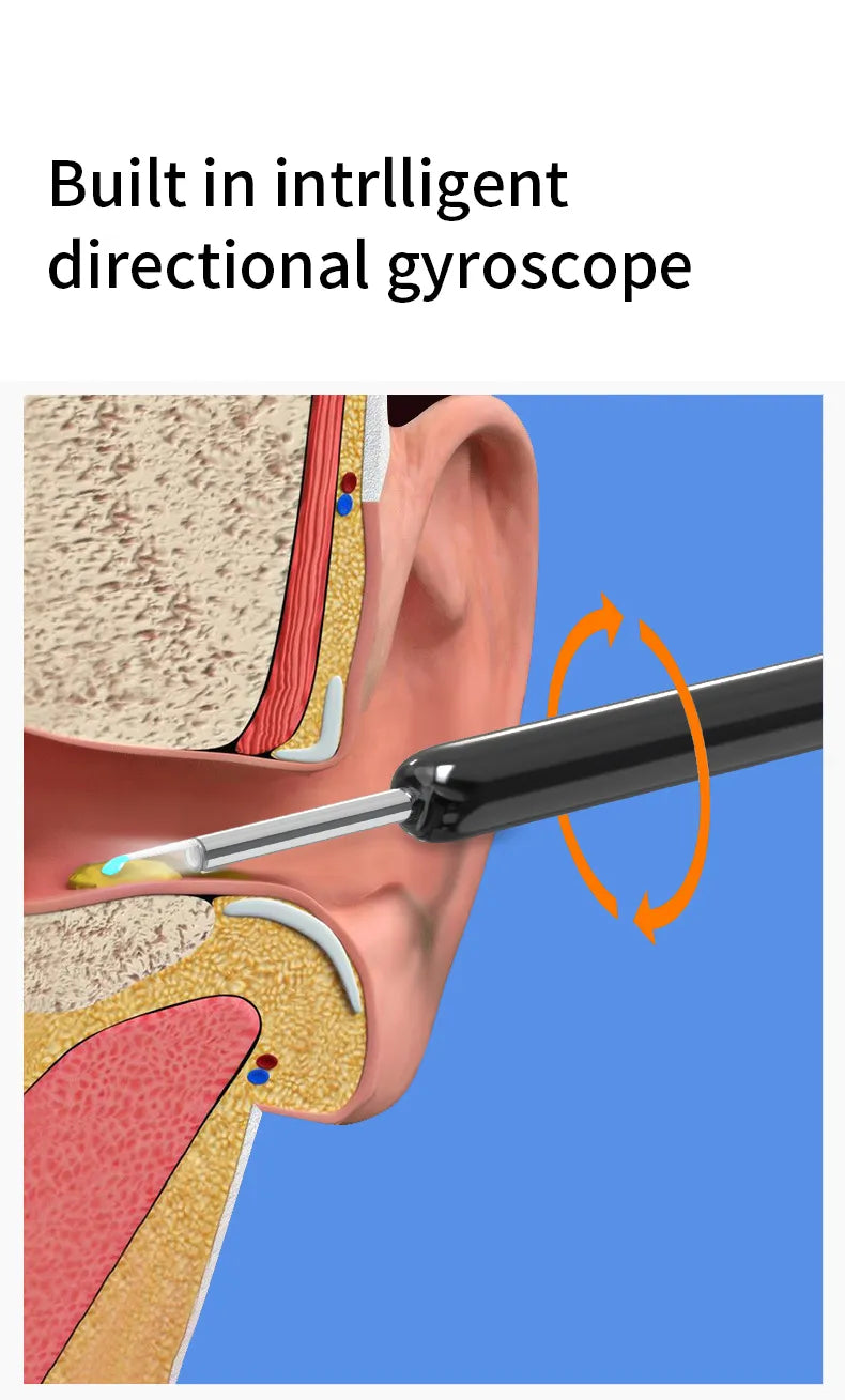 Wireless Intelligent Visual Ear Pick Cleaner