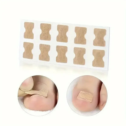 Ingrown Nail Correction Stickers Ivory