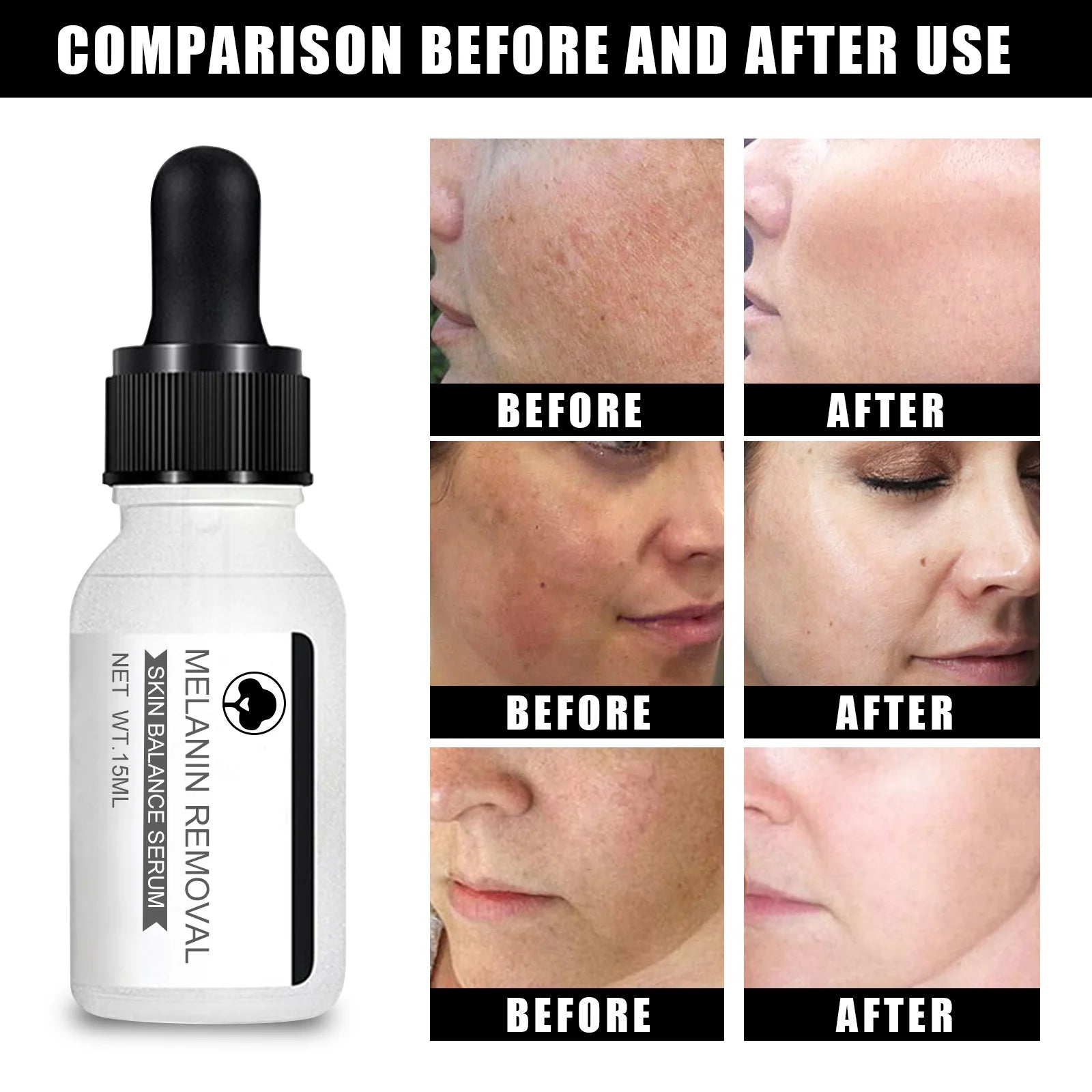 Pigment Removal Serum