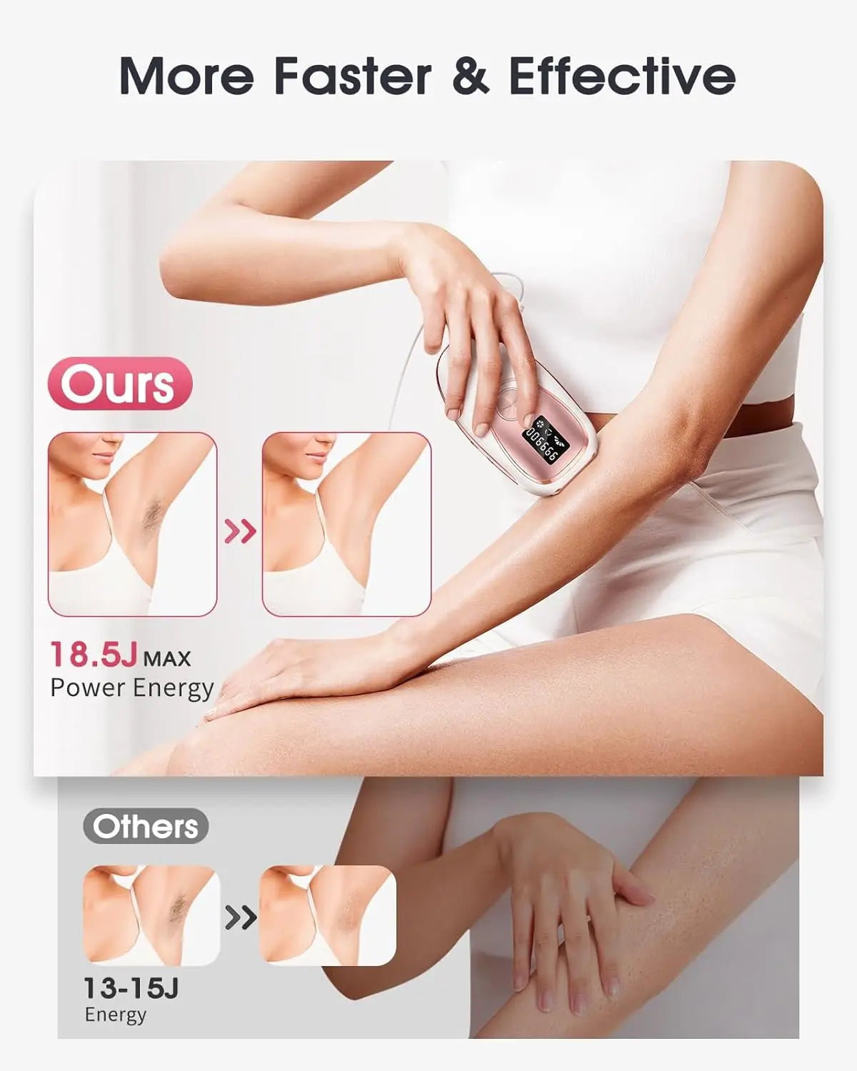 Hair Removal Laser