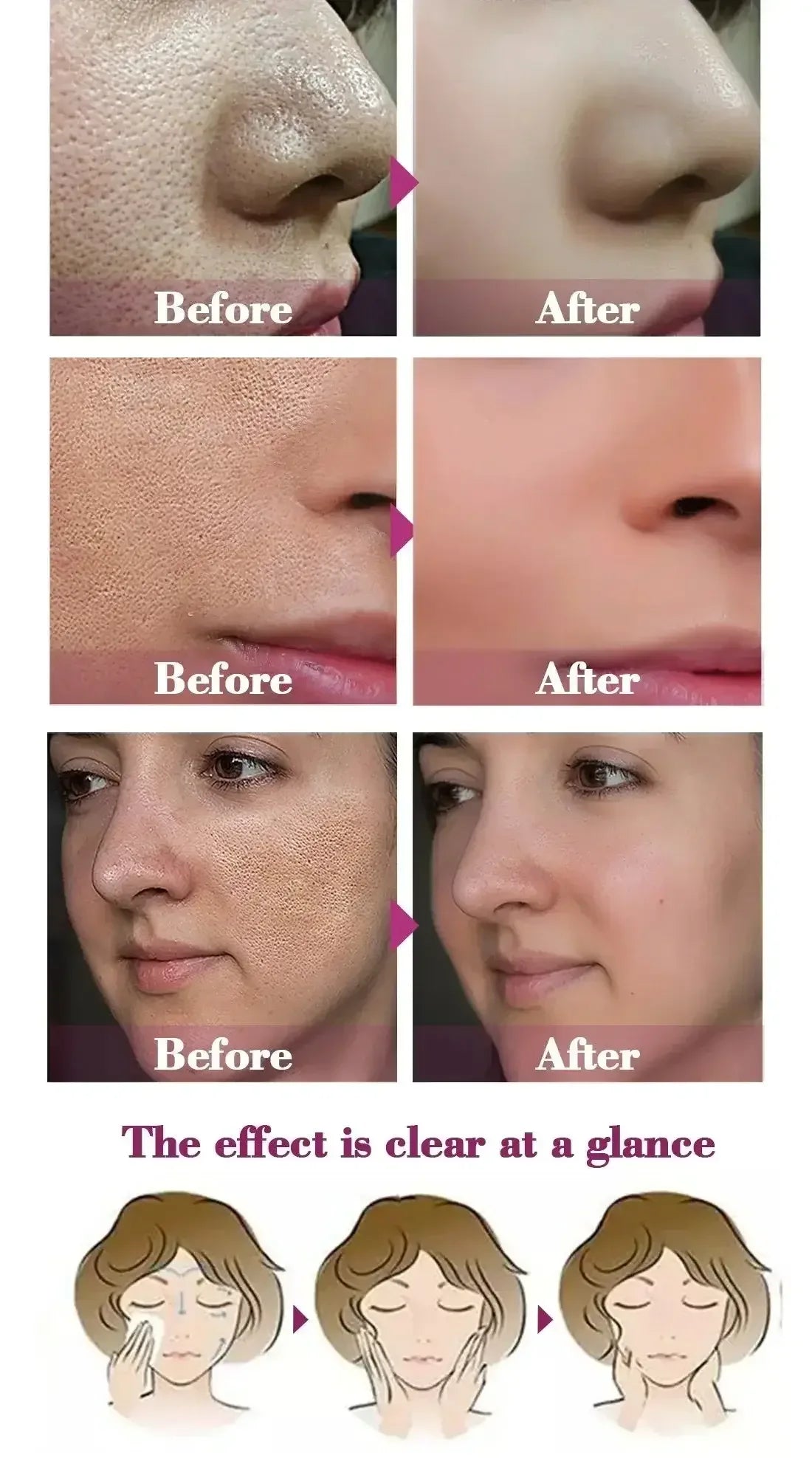 Pore Shrinking Essence Face Repair Essential Oil Remove Blackheads Face Care United States