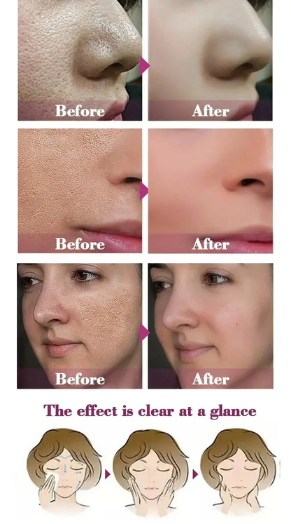 Pore Shrinking Essence Face Repair Essential Oil Remove Blackheads Face Care United States