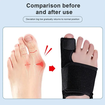 Toe Corrector Orthopedic Tool for Bunion and Hallux Valgus Relief Black Left