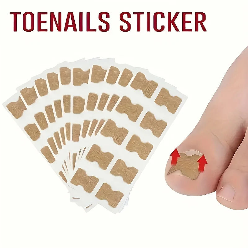 Ingrown Nail Correction Stickers