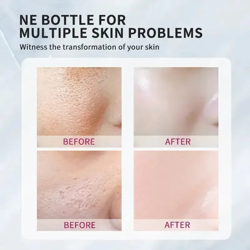 Pore Shrinking Essence Face Repair Essential Oil Remove Blackheads Face Care United States