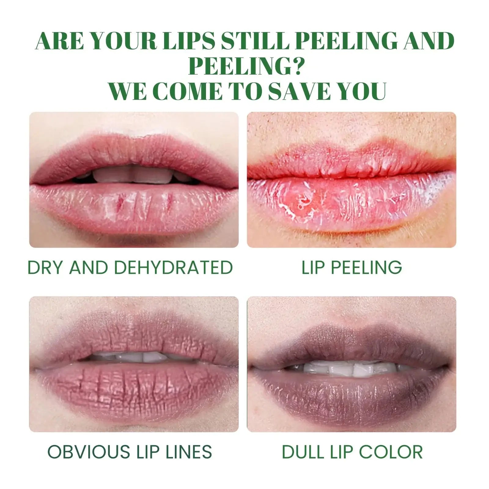 Shopminx Dark Lip Repair Balm & Exfoliating Lip Mask – Brighten & Moisturize United States