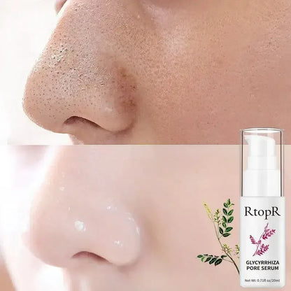 Pore Shrinking Essence Face Repair Essential Oil Remove Blackheads Face Care United States