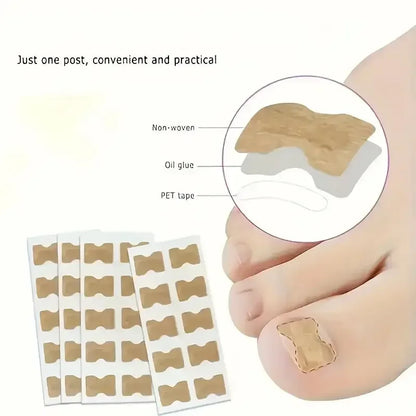 Ingrown Nail Correction Stickers Ivory