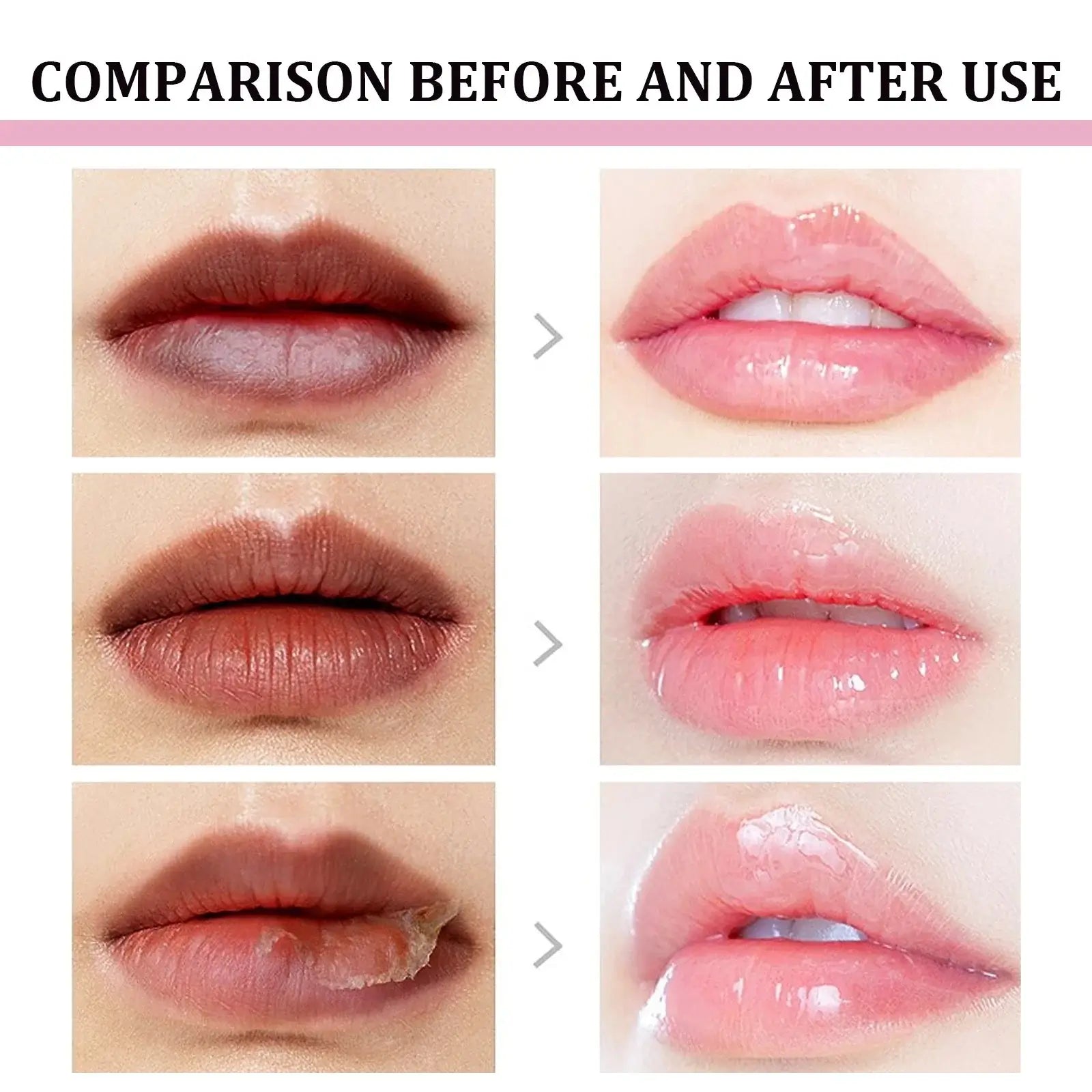 Shopminx Dark Lip Repair Balm & Exfoliating Lip Mask – Brighten & Moisturize United States