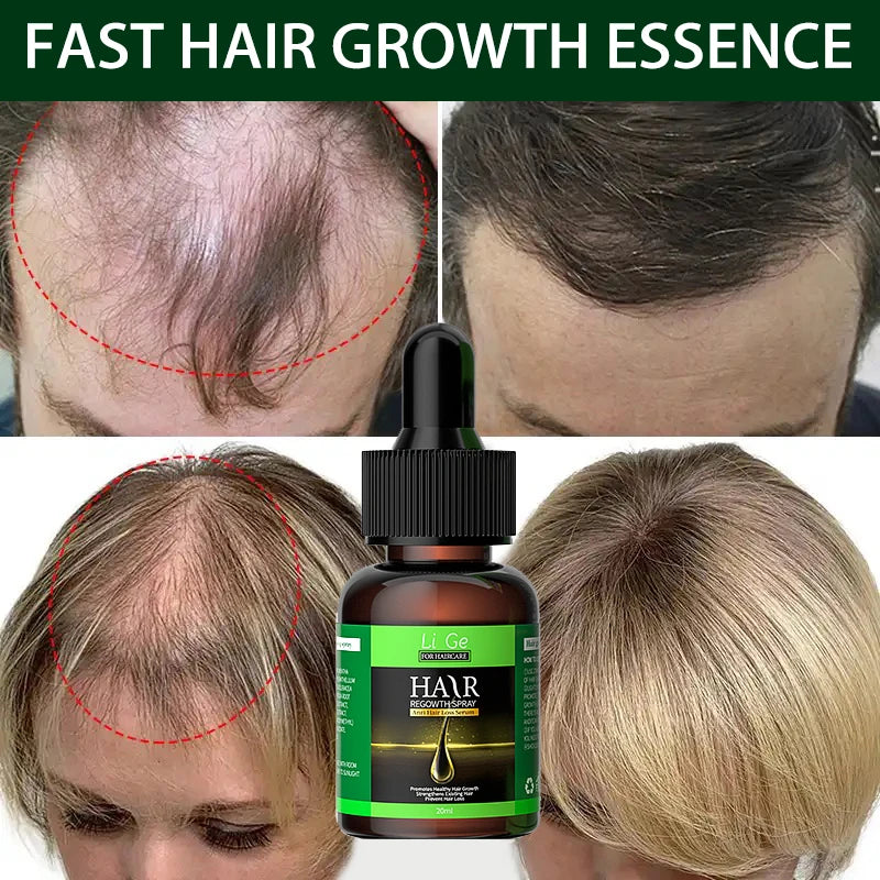 Hair Growth Oil Fast Hair Growth Effective Baldness Repair