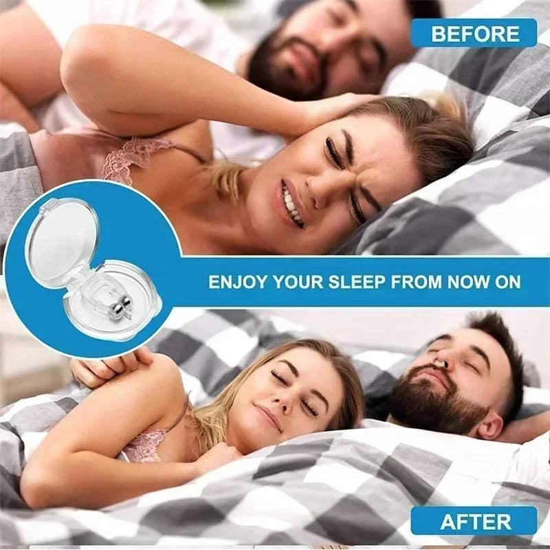 Anti-Snoring Device