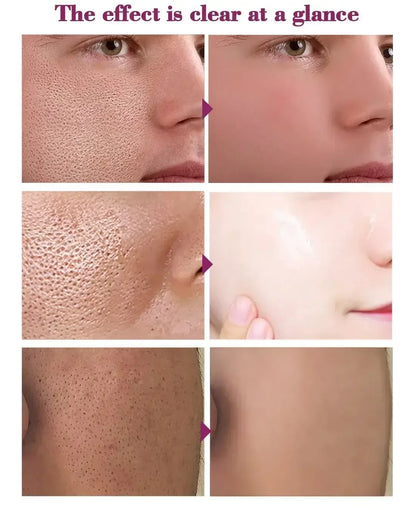 Pore Shrinking Essence Face Repair Essential Oil Remove Blackheads Face Care United States