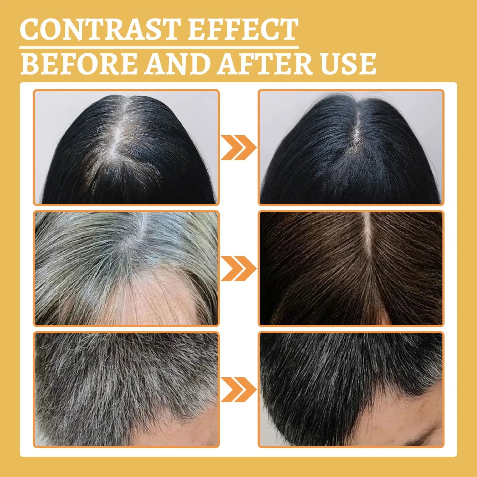 Gray White Hair Treatment Serum