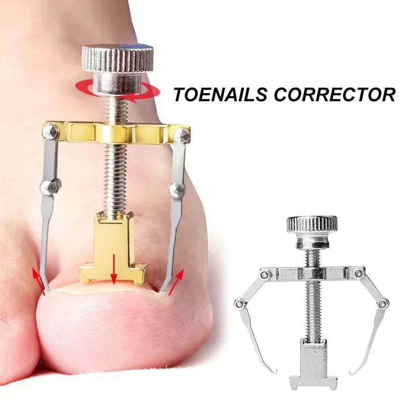 Stainless Steel Nail Ingrown Toenails Corrector Gold